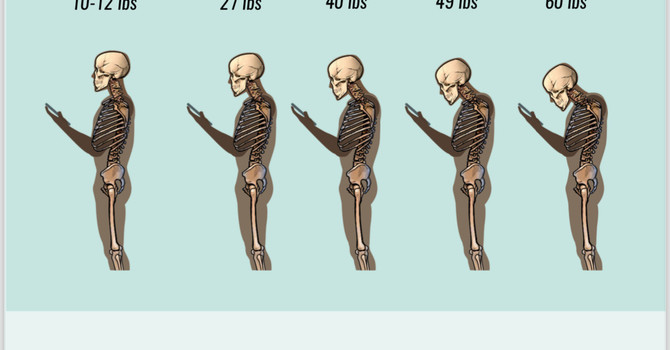 No More Tech Neck: Tips & Exercises to Prevent the Neck Hump image