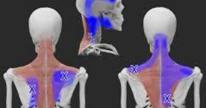 Relieve Upper Back Tension at Home image