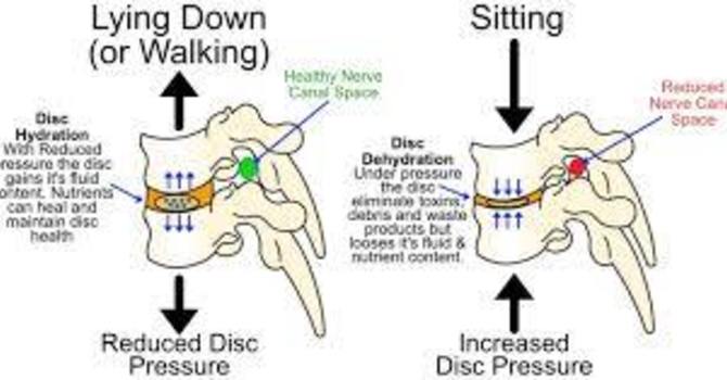 Spinal Discs Go Out Drinking At Night