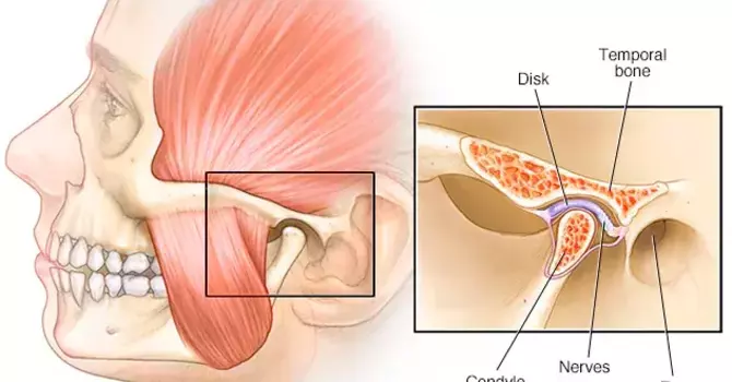 Relieve Jaw Pain with the Scream Exercise