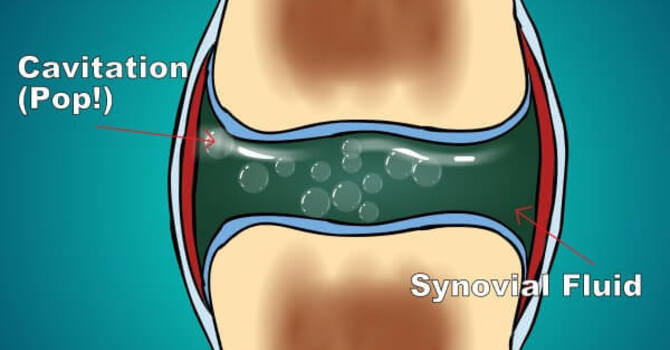 The Truth About the ‘Pop’: What Really Happens During an Adjustment image